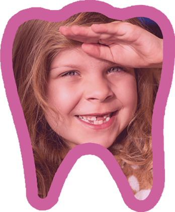 Santa Barbara Children's Dentistry - Space Maintainers - Santa Barbara & Goleta, CA