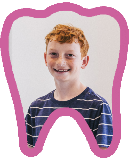 Santa Barbara Children's Dentistry - Space Maintainers - Santa Barbara & Goleta, CA